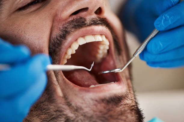Best Emergency Dental Care for Trauma or Injury in Ordway, CO